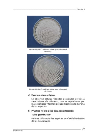Sección 4




               Desarrollo de C. albicans sobre agar sabouraud
                                  dextrosa.




               Desarrollo de C. glabrata sobre agar sabouraud
                                   dextrosa.

              a)	 Examen	microscópico
                 Se observan células redondas u ovaladas de tres a
                 siete micras de diámetro, que se reproducen por
                 blastoconidias y forman pseudomicelio en la mayoría
                 de las especies.

              b)	 Pruebas	fisiológicas	para	identificación
                 Tubo	germinativo
                 Permite diferenciar las especies de Candida albicans
                 de las no albicans.


                                                                      3
INS-CNSP-44
 