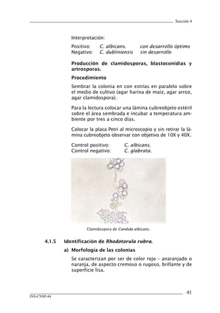 Sección 4



                   Interpretación:
                   Positivo:    C. albicans.         con desarrollo óptimo
                   Negativo:    C. dubliniensis      sin desarrollo

                   Producción	 de	 clamidosporas,	 blastoconidias	 y	
                   artrosporas.
                   Procedimiento
                   Sembrar la colonia en con estrías en paralelo sobre
                   el medio de cultivo (agar harina de maíz, agar arroz,
                   agar clamidospora).

                   Para la lectura colocar una lámina cubreobjeto estéril
                   sobre el área sembrada e incubar a temperatura am-
                   biente por tres a cinco días.

                   Colocar la placa Petri al microscopio y sin retirar la lá-
                   mina cubreobjeto observar con objetivo de 10X y 40X.

                   Control positivo:         C. albicans.
                   Control negativo:         C. glabrata.




                          Clamidospora de Candida albicans.


       4.1.5	   Identificación	de	Rhodotorula rubra.
                a)	 Morfología	de	las	colonias
                   Se caracterizan por ser de color rojo – anaranjado o
                   naranja, de aspecto cremoso o rugoso, brillante y de
                   superficie lisa.



                                                                           41
INS-CNSP-44
 