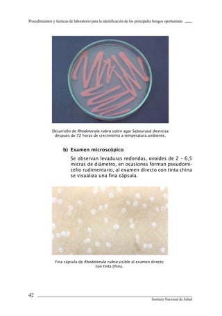 Procedimientos y técnicas de laboratorio para la identificación de los principales hongos oportunistas




               Desarrollo de Rhodotorula rubra sobre agar Sabouraud dextrosa
                después de 72 horas de crecimiento a temperatura ambiente.


                      b)	 Examen	microscópico
                           Se observan levaduras redondas, ovoides de 2 – 6,5
                           micras de diámetro, en ocasiones forman pseudomi-
                           celio rudimentario, al examen directo con tinta china
                           se visualiza una fina cápsula.




                 Fina cápsula de Rhodotorula rubra visible al examen directo
                                      con tinta china.




42
                                                                                 Instituto Nacional de Salud
 