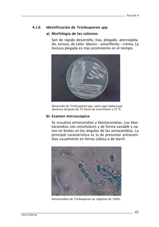 Sección 4



       4.1.6	   Identificación	de	Trichosporon spp.
                a)	 Morfología	de	las	colonias
                   Son de rápido desarrollo, liso, plegado, aterciopela-
                   do, ceroso, de color blanco – amarillento – crema. La
                   textura plegada es más prominente en el tiempo.




                   Desarrollo de Trichosporon spp. sobre agar Sabouraud
                   dextrosa después de 72 horas de crecimiento a 37 ºC.

                b)	 Examen	microscópico
                   Se visualiza artroconidias y blastoconidias. Las blas-
                   toconidias son unicelulares y de forma variable y na-
                   cen en brotes en los ángulos de las artroconidias. La
                   principal característica es la de presentar artroconi-
                   dias usualmente en forma cúbica o de barril.




                   Artroconidias de Trichosporon sp. (objetivo de 100X).



                                                                                 43
INS-CNSP-44
 