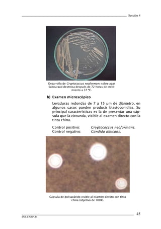 Sección 4




              Desarrollo de Cryptococcus neoformans sobre agar
              Sabouraud dextrosa después de 72 horas de creci-
                               miento a 37 ºC.

              b)	 Examen	microscópico
                 Levaduras redondas de 7 a 15 μm de diámetro, en
                 algunos casos pueden producir blastoconidias. Su
                 principal características es la de presentar una cáp-
                 sula que la circunda, visible al examen directo con la
                 tinta china.

                 Control positivo:            Cryptococcus neoformans.
                 Control negativo:            Candida albicans.




               Cápsula de polisacárido visible al examen directo con tinta
                               china (objetivo de 100X).




                                                                                   45
INS-CNSP-44
 
