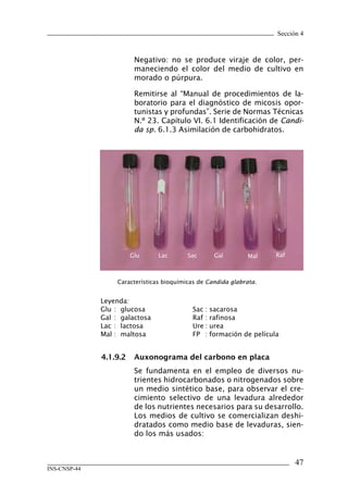 Sección 4



                        Negativo: no se produce viraje de color, per-
                        maneciendo el color del medio de cultivo en
                        morado o púrpura.

                        Remitirse al “Manual de procedimientos de la-
                        boratorio para el diagnóstico de micosis opor-
                        tunistas y profundas”. Serie de Normas Técnicas
                        N.º 23. Capítulo VI. 6.1 Identificación de Candi-
                        da sp. 6.1.3 Asimilación de carbohidratos.




                       Glu       Lac       Sac       Gal       Mal      Raf



                   Características bioquímicas de Candida glabrata.


              Leyenda:
              Glu : glucosa                 Sac :   sacarosa
              Gal : galactosa               Raf :   rafinosa
              Lac : lactosa                 Ure :   urea
              Mal : maltosa                 FP :    formación de película


              4.1.9.2	 Auxonograma	del	carbono	en	placa
                        Se fundamenta en el empleo de diversos nu-
                        trientes hidrocarbonados o nitrogenados sobre
                        un medio sintético base, para observar el cre-
                        cimiento selectivo de una levadura alrededor
                        de los nutrientes necesarios para su desarrollo.
                        Los medios de cultivo se comercializan deshi-
                        dratados como medio base de levaduras, sien-
                        do los más usados:


                                                                              47
INS-CNSP-44
 