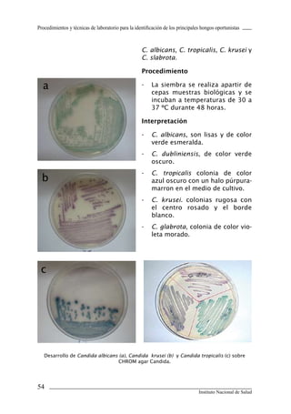 Procedimientos y técnicas de laboratorio para la identificación de los principales hongos oportunistas



                                                    C. albicans, C. tropicalis, C. krusei y
                                                    C. slabrota.

                                                    Procedimiento

  a                                                 -    La siembra se realiza apartir de
                                                         cepas muestras biológicas y se
                                                         incuban a temperaturas de 30 a
                                                         37 ºC durante 48 horas.

                                                    Interpretación

                                                    -    C. albicans, son lisas y de color
                                                         verde esmeralda.
                                                    -    C. dubliniensis, de color verde
                                                         oscuro.
                                                    -    C. tropicalis colonia de color
  b                                                      azul oscuro con un halo púrpura-
                                                         marron en el medio de cultivo.
                                                    -    C. krusei. colonias rugosa con
                                                         el centro rosado y el borde
                                                         blanco.
                                                    -    C. glabrota, colonia de color vio-
                                                         leta morado.




 c




   Desarrollo de Candida albicans (a), Candida krusei (b) y Candida tropicalis (c) sobre
                                  CHROM agar Candida.




54
                                                                                 Instituto Nacional de Salud
 