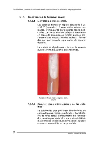Procedimientos y técnicas de laboratorio para la identificación de los principales hongos oportunistas



         5.1.5	       Identificación	de	Fusarium solani.
                      5.1.5.1	 Morfología	de	las	colonias.
                                    Las colonias tienen un rápido desarrollo a 25
                                    y 37 ºC (siete días). El color de las colonias es
                                    blanco, crema, pardo claro o pardo rojizo mez-
                                    cladas con zonas de color púrpura; raramente
                                    en cepas de aislamientos clínicos pueden pre-
                                    sentar masas mucosas verdes azuladas, forma-
                                    das por macroconidias que nacen de esporo-
                                    doquios.

                                    La textura es algodonosa o lanosa. La colonia
                                    puede ser inhibida por la cicloheximida.




                                       Características macroscópicas de F.
                                                      solani.

                      5.1.5.2	 Características	 microscópicas	 de	 las	 colo-
                               nias
                                    Se caracteriza por presentar conidióforos de
                                    esporodoquios cortos, ramificados. Conidiófo-
                                    ros de hifas aéreas generalmente no ramifica-
                                    dos, muy largos, reducidos a una simple fiálide
                                    más o menos cilíndrica, en cuyo ápice se puede
                                    encontrar un conidio no desprendido.


66
                                                                                 Instituto Nacional de Salud
 