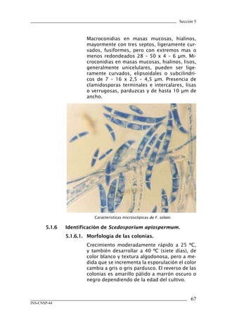 Sección 5



                        Macroconidias en masas mucosas, hialinos,
                        mayormente con tres septos, ligeramente cur-
                        vados, fusiformes, pero con extremos mas o
                        menos redondeados 28 – 50 x 4 – 6 μm. Mi-
                        croconidias en masas mucosas, hialinos, lisos,
                        generalmente unicelulares, pueden ser lige-
                        ramente curvados, elipsoidales o subcilindri-
                        cos de 7 – 16 x 2,5 – 4,5 μm. Presencia de
                        clamidosporas terminales e intercalares, lisas
                        o verrugosas, parduzcas y de hasta 10 μm de
                        ancho.




                            Caracteristicas microscópicas de F. solani.

       5.1.6	   Identificación	de Scedosporium apiospermum.
                5.1.6.1.	 Morfología	de	las	colonias.
                        Crecimiento moderadamente rápido a 25 ºC,
                        y también desarrollar a 40 ºC (siete días), de
                        color blanco y textura algodonosa, pero a me-
                        dida que se incrementa la esporulación el color
                        cambia a gris o gris pardusco. El reverso de las
                        colonias es amarillo pálido a marrón oscuro o
                        negro dependiendo de la edad del cultivo.


                                                                                67
INS-CNSP-44
 