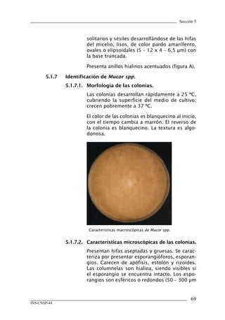 Sección 5



                         solitarios y sésiles desarrollándose de las hifas
                         del micelio, lisos, de color pardo amarillento,
                         ovales o elipsoidales (5 – 12 x 4 – 6,5 μm) con
                         la base truncada.

                         Presenta anillos hialinos acentuados (figura A).

       5.1.7	   Identificación	de	Mucor spp.
                5.1.7.1.	 Morfología	de	las	colonias.
                         Las colonias desarrollan rápidamente a 25 ºC,
                         cubriendo la superficie del medio de cultivo;
                         crecen pobremente a 37 ºC.

                         El color de las colonias es blanquecino al inicio,
                         con el tiempo cambia a marrón. El reverso de
                         la colonia es blanquecino. La textura es algo-
                         donosa.




                          Caracteristicas macroscópicas de Mucor spp.


                5.1.7.2.	 Características	microscópicas	de	las	colonias.
                         Presentan hifas aseptadas y gruesas. Se carac-
                         teriza por presentar esporangióforos, esporan-
                         gios. Carecen de apófisis, estolón y rizoides.
                         Las columnelas son hialina, siendo visibles si
                         el esporangio se encuentra intacto. Los espo-
                         rangios son esféricos o redondos (50 – 300 μm


                                                                              6
INS-CNSP-44
 