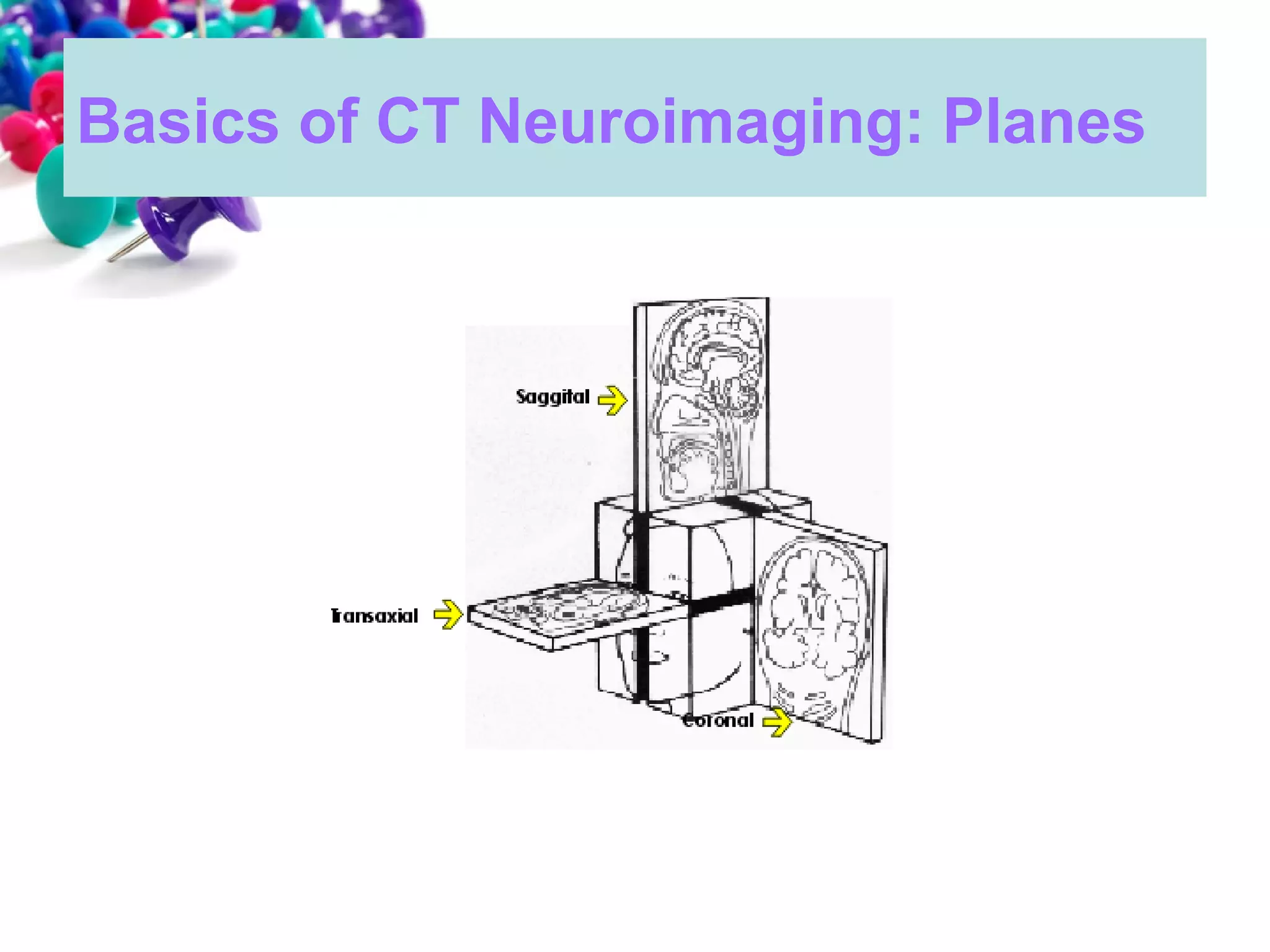 101 ct neuroimaging | PPT