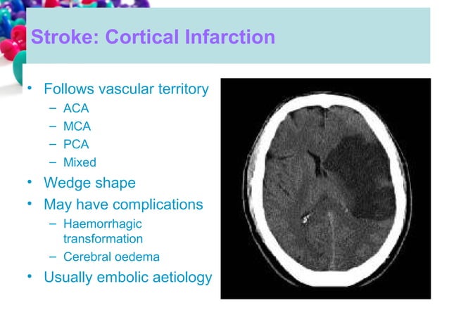 101 ct neuroimaging | PPT | Brain and Nervous System Disorders ...