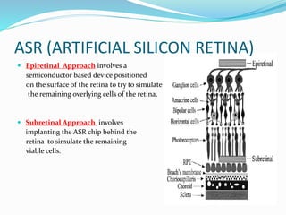  Epiretinal Approach involves a
semiconductor based device positioned
on the surface of the retina to try to simulate
the remaining overlying cells of the retina.
 Subretinal Approach involves
implanting the ASR chip behind the
retina to simulate the remaining
viable cells.
ASR (ARTIFICIAL SILICON RETINA)
 