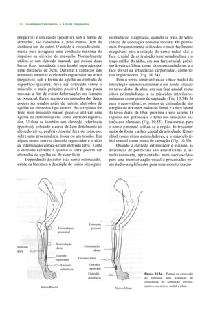 536   Semiologia Veterinária: A Arte do Diagnóstico



(negativo) e um ânodo (positivo), sob a forma de                   estimulação e captação, quando se trata de velo-
eletrodos, são colocados a, pelo menos, 3cm de                     cidade de condução nervosa motora. Os pontos
distância um do outro. O cátodo é colocado distal-                 mais frequentemente utilizados e mais facilmente
mente para assegurar uma condução máxima do                        exequíveis para avaliação do nervo radial são: a
impulso na direção do músculo. Normalmente                         face cranial da articulação umerorradioulnar e o
utiliza-se um eletrodo manual, que possui duas                     terço médio do rádio, em sua face cranial, próxi-
barras fixas (um cátodo e um ânodo) separadas por                  mo à veia cefálica, como sítios estimuladores, e a
uma distância de 3cm. Durante a captação das                       face dorsal da articulação carporradial, como sí-
respostas motoras o eletrodo registrador ou ativo                  tios registradores (Fig. 10.54).
(negativo), sob a forma de agulha ou eletrodo de                        Para o nervo ulnar utiliza-se a face medial da
superfície (jacaré), deve ser colocado sobre o                     articulação umerorradioulnar e um ponto situado
músculo, o mais próximo possível de sua placa                      no terço distai da ulna, em sua face caudal como
motora, a fim de evitar deformações no formato                     sítios estimuladores, e os músculos interósseos
do potencial. Para o registro em músculos dos dedos                palmares como ponto de captação (Fig. 10.54). Já
podem ser usados anéis de metais, eletrodos de                     para o nervo tibial, os pontos de estimulação são
agulha ou eletrodos tipo jacarés. Se o registro for                a região do trocanter maior do fémur e a face lateral
feito num músculo maior, pode-se utilizar uma                      do terço distai da tíbia, próxima à veia safena. O
agulha de eletromiografia como eletrodo registra-                  registro dos potenciais é feito nos músculos in-
dor. Utiliza-se também um eletrodo referência                      terósseos plantares (Fig. 10.55). Finalmente, para
(positivo), colocado a cerca de 3cm distalmente ao                 o nervo peroneal utiliza-se a região do trocanter
eletrodo ativo, preferivelmente fora do músculo,                   maior do fémur e a face caudal da articulação fêmur-
sobre uma proeminência óssea ou um tendão. Em                      tibial como sítios estimuladores, e o músculo ti-
algum ponto entre o eletrodo registrador e o sítio                 bial cranial como ponto de captação (Fig. 10.55).
de estimulação coloca-se um eletrodo terra. Tanto                       Quando o eletrodo estimulador é ativado, as
o eletrodo referência quanto o terra podem ser                     diferenças de potenciais são amplificadas e, si-
eletrodos de agulha ou de superfície.                              multaneamente, apresentadas num osciloscópio
     Dependendo do autor e do nervo estimulado,                    para uma monitorização visual e processadas por
existe na literatura a descrição de vários sítios para             um áudio-amplificador para uma monitorização




                                                     Estimulação
                               Estimulação             proximal
                               proximal


                           Estimulação
Eletrodo                                         Estimulação
                           distai
terra                                                   distai
                           Eletrodo
                           registrador       Eletrodo terra

                                Eletrodo             Eletrodo
                                referência           registrador
                                                     Eletrodo                            Figura 10.54 - Pontos de colocação
                                                     referência                          de eletrodos para avaliação da
                                                                                         velocidade de condução nervosa
                Nervo Radial                                                             motora nos nervos radial e ulnar.
                                                                      Nervo Ulnar
 