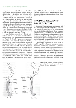 540   Semiologia Veterinária: A Arte do Diagnóstico



falange distai do segundo dedo. A captação é feita         (Fig. 10.59). Os valores médios da velocidade de
sobre o terço proximal do rádio, em sua face cra-          condução nervosa sensitiva dos nervos radial, ulnar,
nial, próximo à veia cefálica, com o eletrodo refe-        tibial e peroneal são, respectivamente, 61m/s, 70m/s,
rência em posição proximal em relação ao regis-            62m/s e 65m/s.
trador e o eletrodo terra colocado entre o registra-
dor c o estimulador, na face dorsal da articulação
carporradial. O nervo ulnar pode ter como sítio de         AVALIAÇÃO DE PACIENTES
estimulação os músculos interósseos palmares (cá-
todo), com o ânodo colocado sobre uma falange do           COM MIELOPATIAS
segundo dedo. O registro pode ser feito na face            A eletromiografia possui duas aplicações princi-
medial da articulação umerorradioulnar com o ele-          pais em doenças da medula espinhal: a localiza-
trodo referência em posição proximal em relação            ção de uma mielopatia através do achado de po-
ao registrador e o eletrodo terra posicionado sobre        tenciais de fibrilação indicando fibras muscula-
o osso acessório do carpo (Fig. 10.58).                    res denervadas e a diferenciação entre polineu-
     Na avaliação do nervo tibial o eletrodo esti-         ropatias ou polimiopatias e mielopatias. As mielo-
mulador (cátodo) é colocado nos músculos interós-          patias causam denervação das fibras musculares
seos plantares, com o ânodo sobre uma falange              através de seus efeitos nos corpos celulares da subs-
do 5a dedo. O eletrodo registrador pode perma-             tância cinzenta da medula espinhal ou na raiz ven-
necer sobre a face lateral do terço distai da tíbia,       tral dos nervos espinhais.
próximo à veia safena, com o eletrodo referência                Inicialmente, avaliam-se os vários níveis da
3cm proximalmente ao registrador e o eletrodo              medula espinhal, colocando-se os eletrodos ex-
terra sobre a tuberosidade calcânea. O nervo               ploratórios nos músculos paraspinais. Os músculos
peroneal pode ter como sítio de estimulação (cá-           paraspinais são inervados pela correspondente raiz
todo) o tendão do músculo tibial cranial, com o            nervosa dentro de um ou dois segmentos medu-
ânodo colocado sobre um osso do tarso. O eletro-           lares. A presença de potenciais anormais nestes
do registrador é colocado caudalmente à articula-          músculos irá indicar uma doença na área medu-
ção fêmur-tibial; referência a 3cm de distância            lar correspondente, no nervo periférico ou no
do registrador, sobre o fémur, e o eletrodo terra          músculo. Em seguida, avaliam-se os músculos dos
entre o registrador e o estimulador, sobre a tíbia         membros torácicos e depois dos pélvicos. Deste


                                                                      Figura 10.58 - Pontos de colocação de eletrodos
                                                                      para avaliação da velocidade de condução nervosa
                                                                      sensitiva nos nervos radial e ulnar.




                                     Eletrodo
                                     referência
                     Eletrodo          Eletrodo -
                                       registrador
                     referência •
                     Eletrodo
                     registrador

                                          Eletrodo
                        Eletrodo          terra
                        terra
                    Ponto de            Ponto de
                    estimulação         estimulação



         Nervo Radial                                 Nervo Ulnar
 