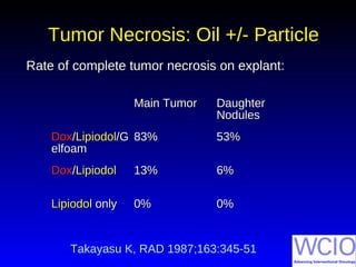Tumor Necrosis: Oil +/- ParticleTumor Necrosis: Oil +/- Particle
Rate of complete tumor necrosis on explant:Rate of complete tumor necrosis on explant:
Main TumorMain Tumor DaughterDaughter
NodulesNodules
DoxDox//LipiodolLipiodol/G/G
elfoamelfoam
83%83% 53%53%
DoxDox//LipiodolLipiodol 13%13% 6%6%
LipiodolLipiodol onlyonly 0%0% 0%0%
Takayasu K, RAD 1987;163:345-51
 