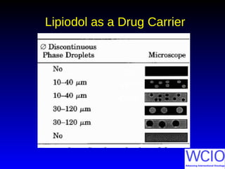 Lipiodol as a Drug Carrier
Oil
W/O
O/W
 