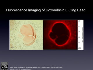 Source: Journal of Vascular and Interventional Radiology 2010; 21:259-267 (DOI:10.1016/j.jvir.2009.10.026 )
Copyright © 2010 SIR Terms and Conditions
Fluorescence Imaging of Doxorubicin Eluting Bead
 