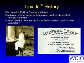 LipiodolLipiodol®®
HistoryHistory
Discovered in 1901 by Guerbet and LafayDiscovered in 1901 by Guerbet and Lafay
Used as a vector of Iodine for tuberculosis, syphilis, rheumatoidUsed as a vector of Iodine for tuberculosis, syphilis, rheumatoid
arthritis, and goiterarthritis, and goiter
In 1926 LipiodolIn 1926 Lipiodol®®
becomes the first iodinated contrast medium usedbecomes the first iodinated contrast medium used
in radiologyin radiology
 
