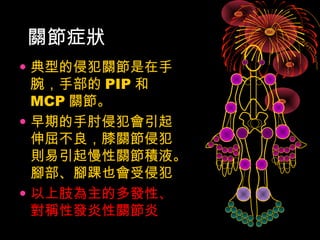 關節症狀 
• 典型的侵犯關節是在手 
腕，手部的PIP和 
MCP關節。 
• 早期的手肘侵犯會引起 
伸屈不良，膝關節侵犯 
則易引起慢性關節積液。 
腳部、腳踝也會受侵犯 
• 以上肢為主的多發性、 
對稱性發炎性關節炎 
 