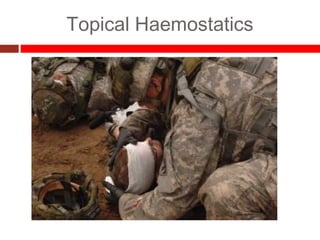 Topical Haemostatics
 