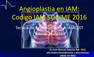 Angioplastia en IAM:
Codigo IAM SOCIME 2016
Dr Juan Manuel Palacios Rdz FACC
Jefe Depto Hemodinamia e Intervencion
UMAE 34 IMSS
Tecnica De Reperfusion en el IAMCEST
UMAE 34 IMSS
 