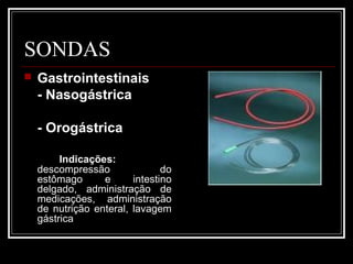 SONDAS
 Gastrointestinais
- Nasogástrica
- Orogástrica
Indicações:
descompressão do
estômago e intestino
delgado, administração de
medicações, administração
de nutrição enteral, lavagem
gástrica
 