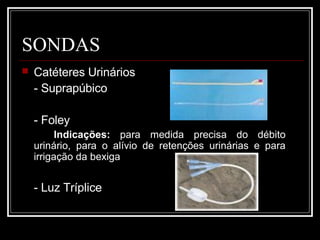 SONDAS
 Catéteres Urinários
- Suprapúbico
- Foley
Indicações: para medida precisa do débito
urinário, para o alívio de retenções urinárias e para
irrigação da bexiga
- Luz Tríplice
 