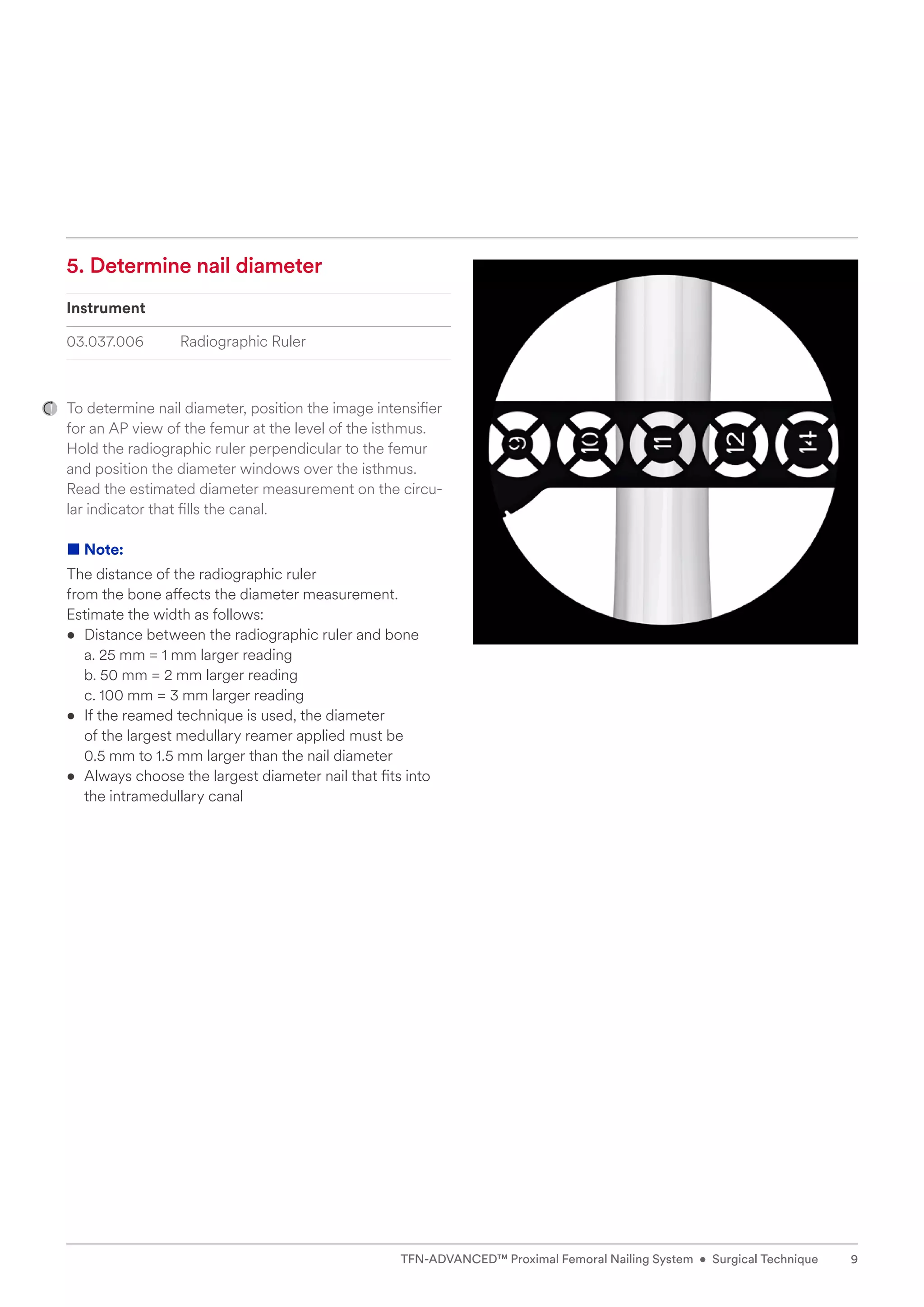 5. Determine nail diameter
Instrument
03.037.006 Radiographic Ruler
To determine nail diameter, position the image intensifier
for an AP view of the femur at the level of the isthmus.
Hold the radiographic ruler perpendicular to the femur
and position the diameter windows over the isthmus.
Read the estimated diameter measurement on the circu-
lar indicator that fills the canal.
■ Note:
The distance of the radiographic ruler
from the bone affects the diameter measurement.
Estimate the width as follows:
• 
Distance between the radiographic ruler and bone
a. 25 mm = 1 mm larger reading
b. 50 mm = 2 mm larger reading
c. 100 mm = 3 mm larger reading
• 
If the reamed technique is used, the diameter
of the largest medullary reamer applied must be
0.5 mm to 1.5 mm larger than the nail diameter
• 
Always choose the largest diameter nail that fits into
the intramedullary canal
9
TFN-ADVANCED™ Proximal Femoral Nailing System • Surgical Technique
 