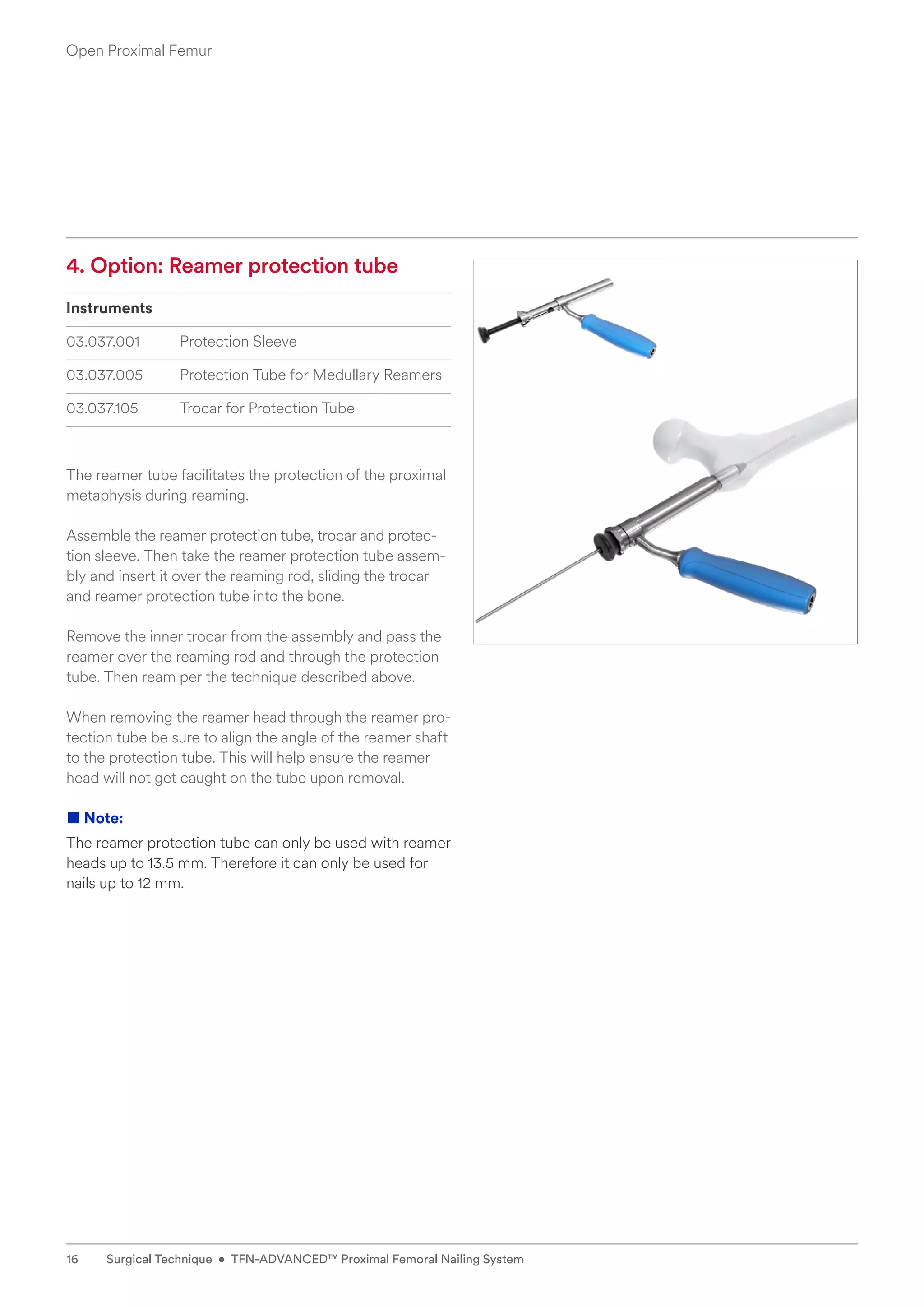 4. Option: Reamer protection tube
Instruments
03.037.001 Protection Sleeve
03.037.005 Protection Tube for Medullary Reamers
03.037.105 Trocar for Protection Tube
The reamer tube facilitates the protection of the proximal
metaphysis during reaming.
Assemble the reamer protection tube, trocar and protec-
tion sleeve. Then take the reamer protection tube assem-
bly and insert it over the reaming rod, sliding the trocar
and reamer protection tube into the bone.
Remove the inner trocar from the assembly and pass the
reamer over the reaming rod and through the protection
tube. Then ream per the technique described above.
When removing the reamer head through the reamer pro-
tection tube be sure to align the angle of the reamer shaft
to the protection tube. This will help ensure the reamer
head will not get caught on the tube upon ­
removal.
■ Note:
The reamer protection tube can only be used with reamer
heads up to 13.5 mm. Therefore it can only be used for
nails up to 12 mm.
Open Proximal Femur
16 Surgical Technique • TFN-ADVANCED™ Proximal Femoral Nailing System
 