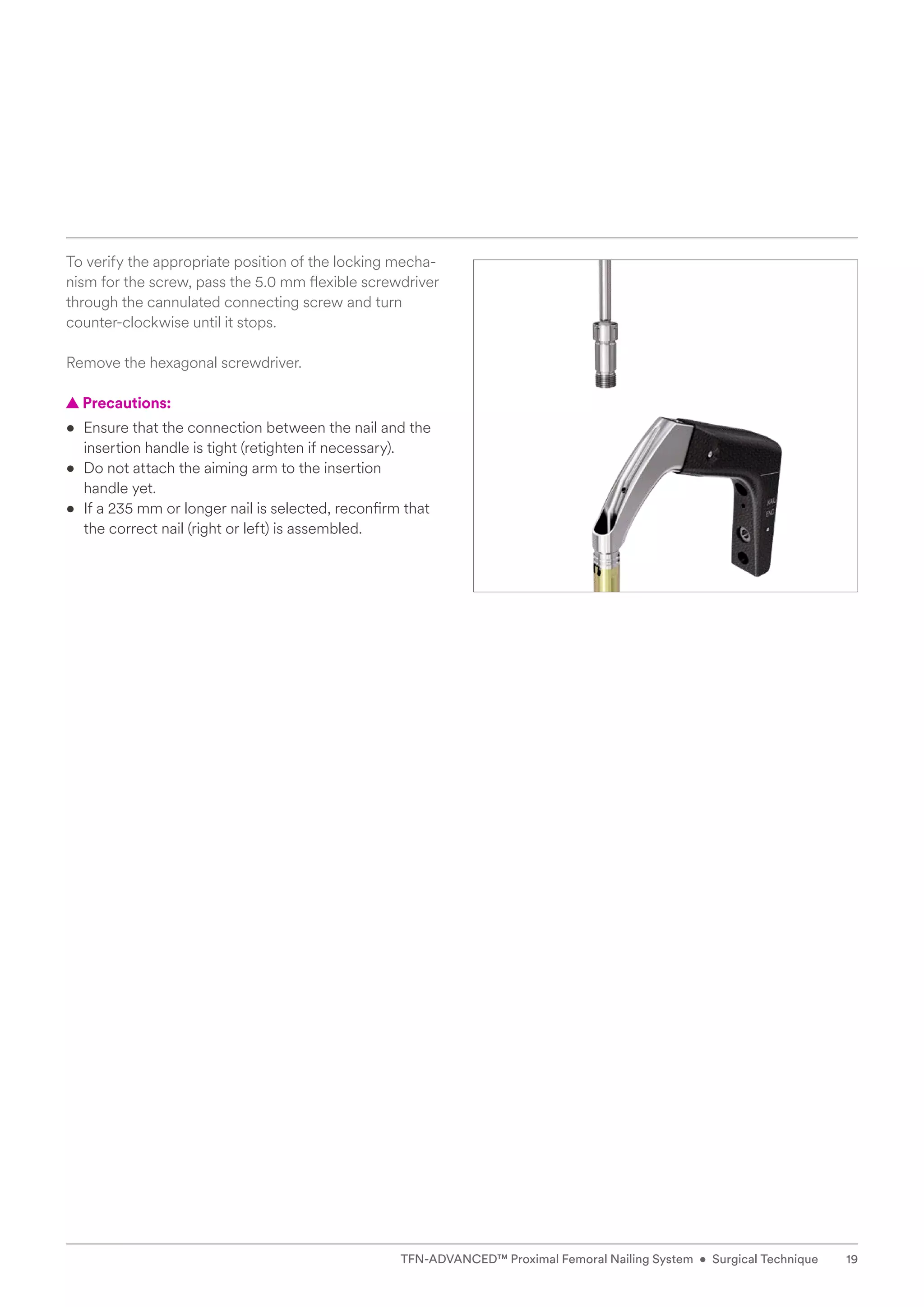 To verify the appropriate position of the locking mecha-
nism for the screw, pass the 5.0 mm flexible screwdriver
through the cannulated connecting screw and turn
­
counter-clockwise until it stops.
Remove the hexagonal screwdriver.
  
▲ Precautions:
• 
Ensure that the connection between the nail and the
insertion handle is tight (retighten if necessary).
• 
Do not attach the aiming arm to the insertion
handle yet.
• 
If a 235 mm or longer nail is selected, reconfirm that
the correct nail (right or left) is assembled.
19
TFN-ADVANCED™ Proximal Femoral Nailing System • Surgical Technique
 
