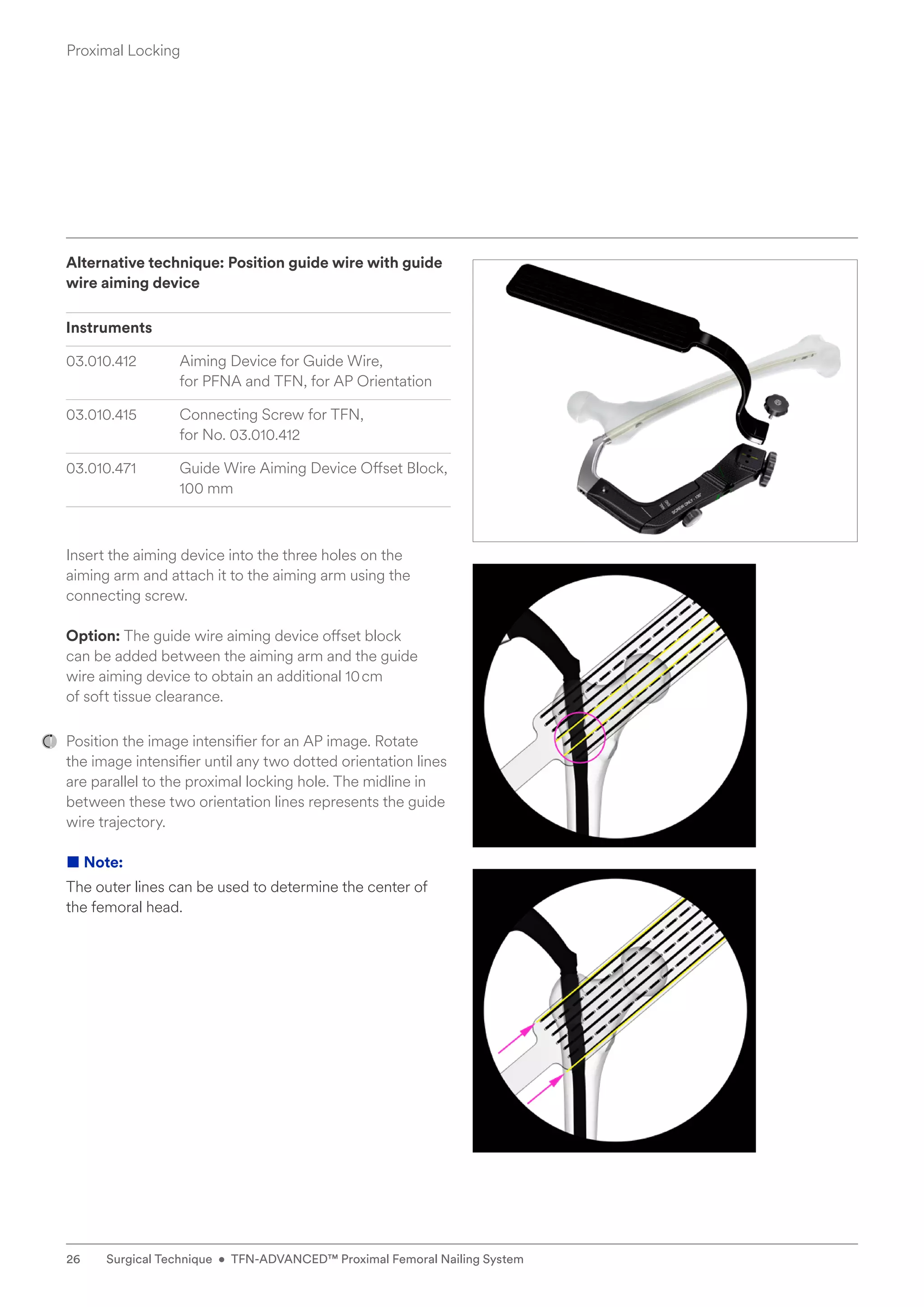 Alternative technique: Position guide wire with guide
wire aiming device
Instruments
03.010.412 Aiming Device for Guide Wire,
for PFNA and TFN, for AP Orientation
03.010.415 Connecting Screw for TFN,
for No. 03.010.412
03.010.471 Guide Wire Aiming Device Offset Block,
100 mm
Insert the aiming device into the three holes on the
aiming arm and attach it to the aiming arm using the
connecting screw.
Option: The guide wire aiming device offset block
can be added between the aiming arm and the guide
wire aiming device to obtain an additional 10cm
of soft tissue clearance.
Position the image intensifier for an AP image. Rotate
the image intensifier until any two dotted orientation lines
are parallel to the proximal locking hole. The midline in
between these two orientation lines represents the guide
wire trajectory.
■ Note:
The outer lines can be used to determine the center of
the femoral head.
Proximal Locking
26 Surgical Technique • TFN-ADVANCED™ Proximal Femoral Nailing System
 