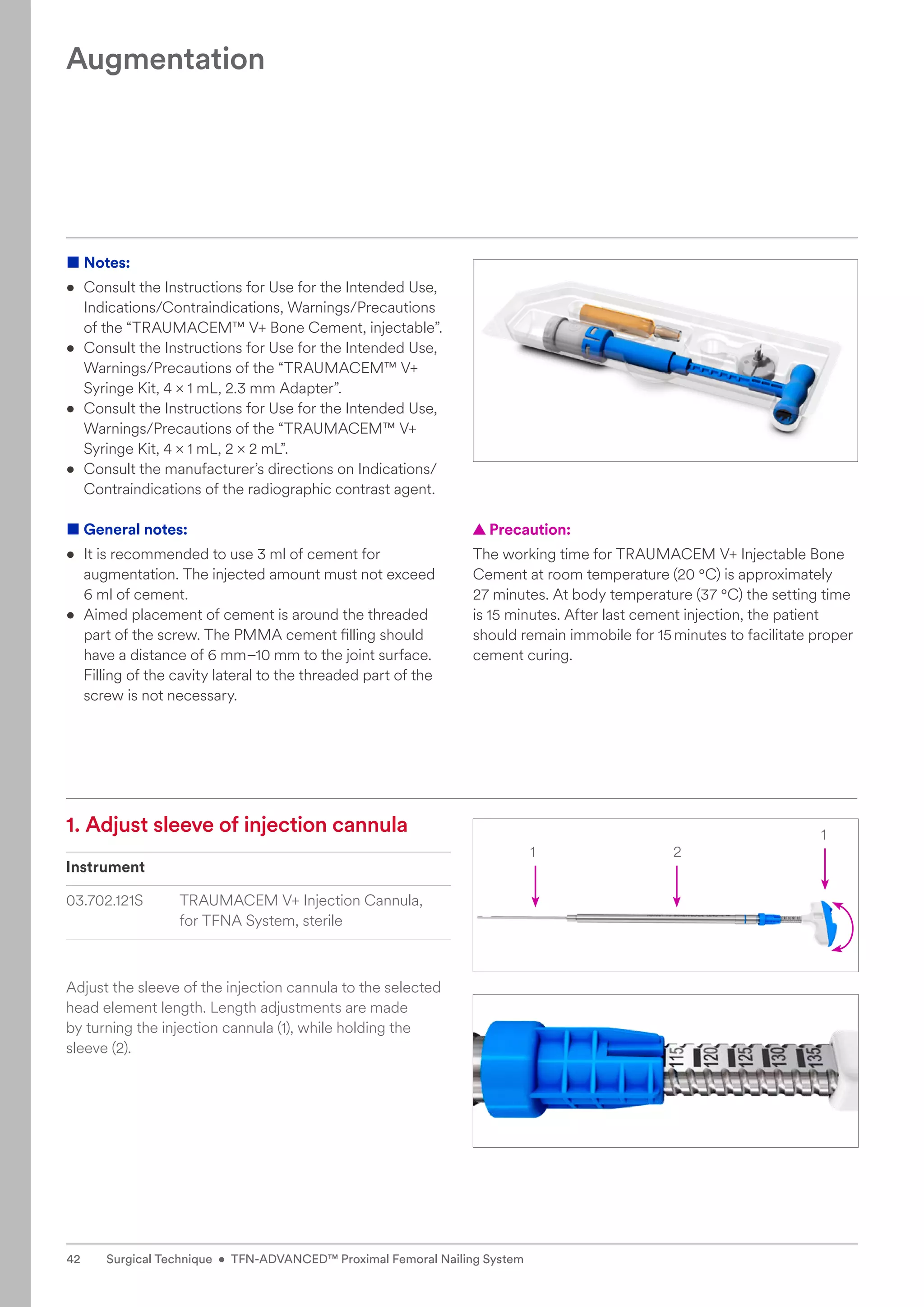 1 2
1
1. 
Adjust sleeve of injection cannula
Instrument
03.702.121S TRAUMACEM V+ Injection Cannula,
for TFNA System, sterile
Adjust the sleeve of the injection cannula to the selected
head element length. Length adjustments are made ­
by turning the injection cannula (1), while holding the
sleeve (2).
■ Notes:
• Consult the Instructions for Use for the Intended Use,
Indications/Contraindications, Warnings/Precautions
of the “TRAUMACEM™ V+ Bone Cement, injectable”.
• Consult the Instructions for Use for the Intended Use,
Warnings/Precautions of the “TRAUMACEM™ V+
Syringe Kit, 4 × 1 mL, 2.3 mm Adapter”.
• Consult the Instructions for Use for the Intended Use,
Warnings/Precautions of the “TRAUMACEM™ V+
Syringe Kit, 4 × 1 mL, 2 × 2 mL”.
• Consult the manufacturer’s directions on Indications/
Contraindications of the radiographic contrast agent.
■ General notes:
• 
It is recommended to use 3 ml of cement for
augmentation. The injected amount must not exceed
6 ml of cement.
• 
Aimed placement of cement is around the threaded
part of the screw. The PMMA cement filling should
have a distance of 6 mm–10 mm to the joint surface.
Filling of the cavity lateral to the threaded part of the
screw is not necessary.
Augmentation
  
▲ Precaution:
The working time for TRAUMACEM V+ Injectable Bone
Cement at room temperature (20 °C) is approximately
27 minutes. At body temperature (37 °C) the setting time
is 15 minutes. After last cement injection, the patient
should remain immobile for 15minutes to facilitate proper
cement curing.
42 Surgical Technique • TFN-ADVANCED™ Proximal Femoral Nailing System
 