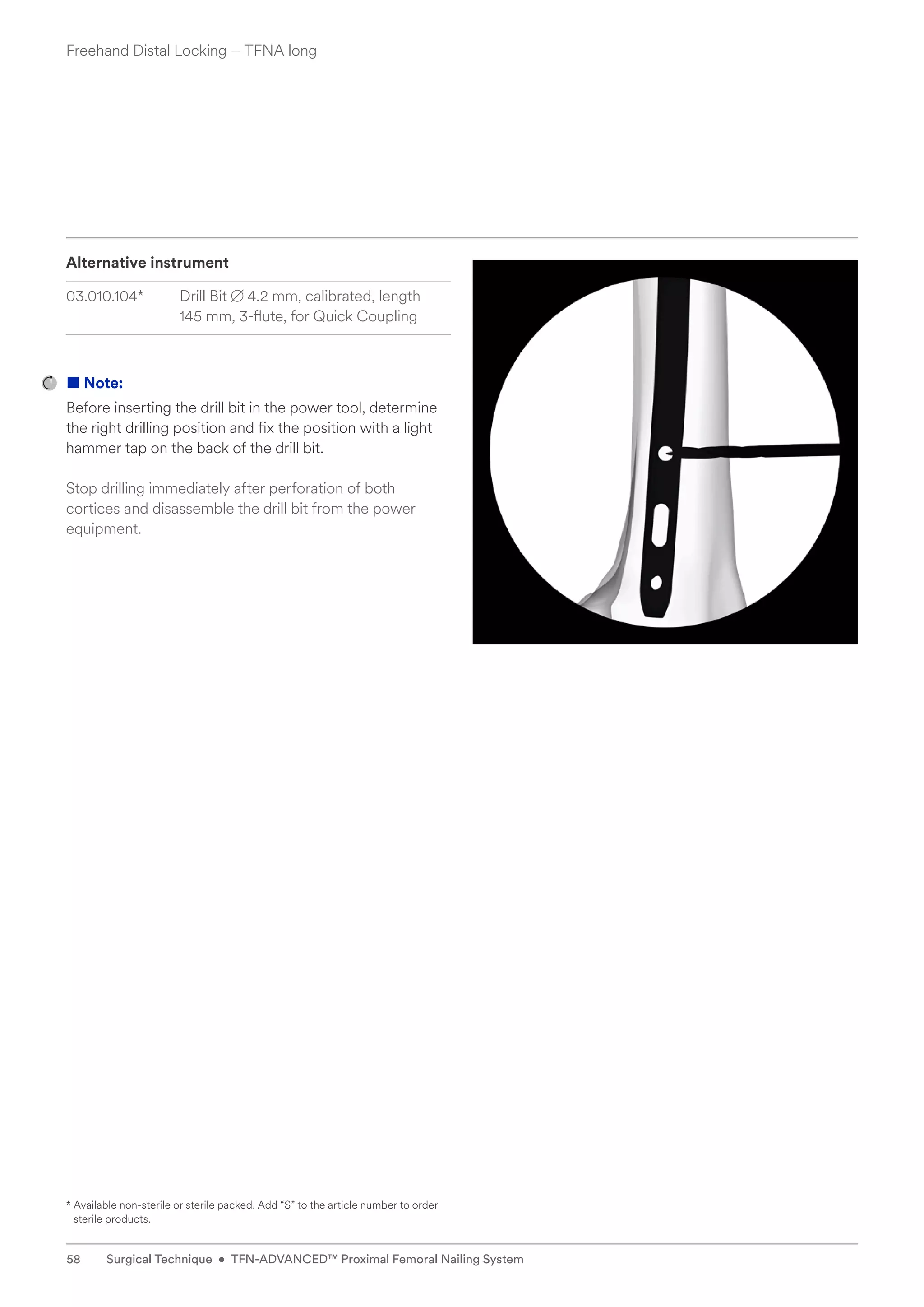 Alternative instrument
03.010.104* Drill Bit B 4.2 mm, calibrated, length
145 mm, 3-flute, for Quick Coupling
■ Note:
Before inserting the drill bit in the power tool, determine
the right drilling position and fix the position with a light
hammer tap on the back of the drill bit.
Stop drilling immediately after perforation of both
­
cortices and disassemble the drill bit from the power
equipment.
* 
Available non-sterile or sterile packed. Add “S” to the article number to order
sterile products.
Freehand Distal Locking – TFNA long
58 Surgical Technique • TFN-ADVANCED™ Proximal Femoral Nailing System
 