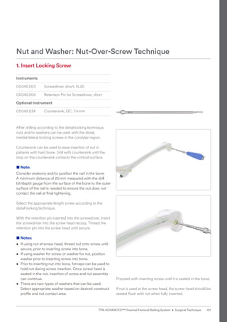 Nut and Washer: Nut-Over-Screw Technique
1. Insert Locking Screw
Instruments
03.045.003 Screwdriver, short, XL25
03.045.004 Retention Pin for Screwdriver, short
Optional Instrument
03.045.034 Countersink, QC, 7.4mm
After drilling according to the distal locking technique,
nuts and/or washers can be used with the distal,
medial-lateral locking screws in the condylar region.
Countersink can be used to ease insertion of nut in
patients with hard bone. Drill with countersink until the
stop on the countersink contacts the cortical surface.
■ Note:
Consider anatomy and/or position the nail in the bone.
A minimum distance of 20mm measured with the drill
bit/depth gauge from the surface of the bone to the outer
surface of the nail is needed to ensure the nut does not
contact the nail at final tightening.
Select the appropriate length screw according to the
distal locking technique.
With the retention pin inserted into the screwdriver, insert
the screwdriver into the screw head recess. Thread the
retention pin into the screw head until secure.
■ Notes:
• 
If using nut at screw head, thread nut onto screw until
secure, prior to inserting screw into bone.
• 
If using washer for screw or washer for nut, position
washer prior to inserting screw into bone.
• 
Prior to inserting nut into bone, forceps can be used to
hold nut during screw insertion. Once screw head is
seated in the nut, insertion of screw and nut assembly
can continue.
• There are two types of washers that can be used.
Select appropriate washer based on desired construct
profile and nut contact area.
Proceed with inserting screw until it is seated in the bone.
If nut is used at the screw head, the screw head should be
seated flush with nut when fully inserted.
101
TFN-ADVANCED™ Proximal Femoral Nailing System • Surgical Technique
 