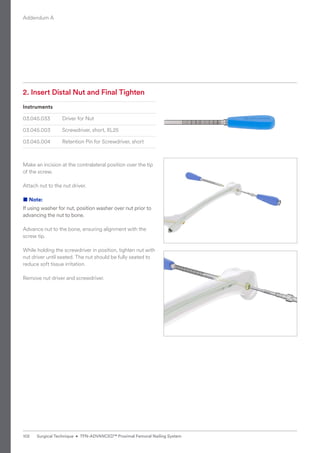2. Insert Distal Nut and Final Tighten
Instruments
03.045.033 Driver for Nut
03.045.003 Screwdriver, short, XL25
03.045.004 Retention Pin for Screwdriver, short
Make an incision at the contralateral position over the tip
of the screw.
Attach nut to the nut driver.
■ Note:
If using washer for nut, position washer over nut prior to
advancing the nut to bone.
Advance nut to the bone, ensuring alignment with the
screw tip.
While holding the screwdriver in position, tighten nut with
nut driver until seated. The nut should be fully seated to
reduce soft tissue irritation.
Remove nut driver and screwdriver.
Addendum A
102 Surgical Technique • TFN-ADVANCED™ Proximal Femoral Nailing System
 