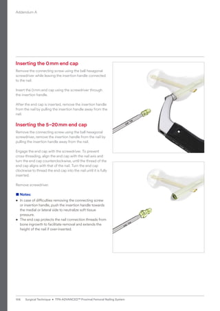 Inserting the 0mm end cap
Remove the connecting screw using the ball hexagonal
screwdriver while leaving the insertion handle connected
to the nail.
Insert the 0mm end cap using the screwdriver through
the insertion handle.
After the end cap is inserted, remove the insertion handle
from the nail by pulling the insertion handle away from the
nail.
Inserting the 5–20mm end cap
Remove the connecting screw using the ball hexagonal
screwdriver, remove the insertion handle from the nail by
pulling the insertion handle away from the nail.
Engage the end cap with the screwdriver. To prevent
cross-threading, align the end cap with the nail axis and
turn the end cap counterclockwise, until the thread of the
end cap aligns with that of the nail. Turn the end cap
clockwise to thread the end cap into the nail until it is fully
inserted.
Remove screwdriver.
■ Notes:
• 
In case of difficulties removing the connecting screw
or insertion handle, push the insertion handle towards
the medial or lateral side to neutralize soft tissue
pressure.
• 
The end cap protects the nail connection threads from
bone ingrowth to facilitate removal and extends the
height of the nail if over-inserted.
Addendum A
106 Surgical Technique • TFN-ADVANCED™ Proximal Femoral Nailing System
 