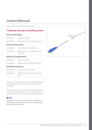 Implant removal is an optional procedure.
1. 
Remove end cap and locking screws
Removal of End Caps
03.045.011 Screwdriver XL40
03.045.012 Retention Pin for Screwdriver XL40
Alternative Instruments
03.045.013 Screwdriver XL40, extra long
03.045.014 Retention Pin for Screwdriver XL40,
extra long
Removal of Locking Screws
03.045.001 Screwdriver XL25
03.045.002 Retention Pin for Screwdriver XL25
Alternative Instruments
03.045.003 Screwdriver, short, XL25
03.045.004 Retention Pin for Screwdriver XL25,
short
Clear the recess of the end cap and the locking implants
of any ingrown tissue. Remove the end cap using the
screwdriver.
Remove all locking screws except one proximal locking
screw using the screwdriver. Refer to retaining screw
guidance above, to lock screws to suitable screwdrivers.
■ Note:
Retaining end caps are compatible with existing T40
screwdrivers, and retaining screws are compatible with
existing T25 screwdrivers.
Implant Removal
107
TFN-ADVANCED™ Proximal Femoral Nailing System • Surgical Technique
 
