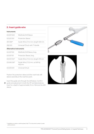 2. Insert guide wire
Instruments
03.037.000 Multihole Drill Sleeve
03.037.001 Protection Sleeve
357.399* Guide Wire B 3.2mm, length 400mm
393.100 Universal Chuck with T-Handle
Alternative instruments
03.037.100 Multihole Drill Sleeve, long
03.037.101 Protection Sleeve, long
09.037.010* Guide Wire B 3.2mm, length 475mm
03.045.018* Guide Wire B 3.2mm, w/drill tip,
400mm
03.043.001 Universal Chuck
Position the protection sleeve and the multi hole drill
sleeve assembly at the insertion point.
Insert the guide wire through the drill sleeve. Confirm
guide wire placement in both the AP and lateral planes.
Insert to a depth of approximately 15cm. Remove the drill
sleeve.
* 
Available non-sterile or sterile packed. Add “S” to the article number to order
sterile products.
11
TFN-ADVANCED™ Proximal Femoral Nailing System • Surgical Technique
 