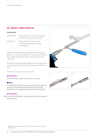 1 2
3a. Option: Hollow Reamer
Instruments
03.037.004* Hollow Reamer B 16 mm, cannulated,
for Quick Coupling for DHS/DCS
03.037.104* Hollow Reamer B 16 mm, long,
cannulated, for Quick Coupling
for DHS/DCS
Make sure that the centering mechanism of the Hollow
Reamer is in the correct position: it must be pushed from
the coupling end (1) towards the cutting end (2) of the ­
instrument
Guide the cannulated Hollow Reamer over the guide wire
through the protection sleeve to the bone and drill to the
stop.
Remove and dispose of the guide wire.
  
▲ Precaution:
Guide Wires are single-use items, do not re-use.
■ Note:
In hard bone it might be necessary to repeat the opening
process with either the flexible drill bits 03.037.002/
03.037.102 or the solid drill bits 03.037.003/03.037.103.
  
▲ Precaution:
Monitor the drill depth under image intensifier throughout
the procedure.
* 
Available non-sterile or sterile packed. Add S to the article number to order
sterile products.
Open Proximal Femur
14 Surgical Technique • TFN-ADVANCED™ Proximal Femoral Nailing System
 
