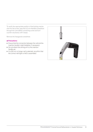 To verify the appropriate position of the locking mecha-
nism for the screw, pass the 5.0 mm flexible screwdriver
through the cannulated connecting screw and turn
­
counter-clockwise until it stops.
Remove the hexagonal screwdriver.
  
▲ Precautions:
• 
Ensure that the connection between the nail and the
insertion handle is tight (retighten if necessary).
• 
Do not attach the aiming arm to the insertion
handle yet.
• 
If a 235 mm or longer nail is selected, reconfirm that
the correct nail (right or left) is assembled.
19
TFN-ADVANCED™ Proximal Femoral Nailing System • Surgical Technique
 