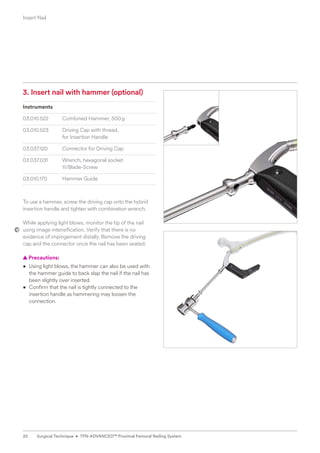 3. Insert nail with hammer (optional)
Instruments
03.010.522 Combined Hammer, 500g
03.010.523 Driving Cap with thread,
for Insertion Handle
03.037.120 Connector for Driving Cap
03.037.031 Wrench, hexagonal socket
11/Blade-Screw
03.010.170 Hammer Guide
To use a hammer, screw the driving cap onto the hybrid
insertion handle and tighten with combination wrench.
While applying light blows, monitor the tip of the nail
using image intensification. Verify that there is no
evidence of impingement distally. Remove the driving
cap and the connector once the nail has been seated.
  
▲ Precautions:
• Using light blows, the hammer can also be used with
the hammer guide to back slap the nail if the nail has
been slightly over inserted.
• Confirm that the nail is tightly connected to the
insertion handle as hammering may loosen the
connection.
Insert Nail
22 Surgical Technique • TFN-ADVANCED™ Proximal Femoral Nailing System
 