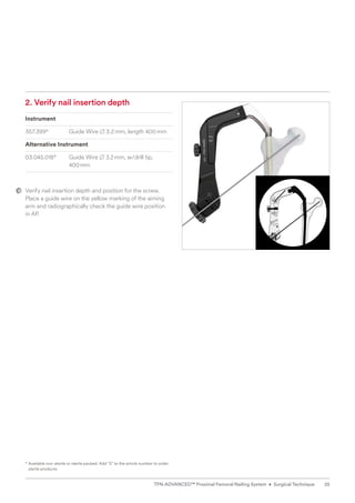 2. Verify nail insertion depth
Instrument
357.399* Guide Wire B 3.2mm, length 400mm
Alternative Instrument
03.045.018* Guide Wire B 3.2mm, w/drill tip,
400mm
Verify nail insertion depth and position for the screw.
Place a guide wire on the yellow marking of the aiming
arm and radiographically check the guide wire position
in AP.
* 
Available non-sterile or sterile packed. Add “S” to the article number to order
sterile products.
25
TFN-ADVANCED™ Proximal Femoral Nailing System • Surgical Technique
 