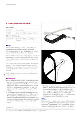 10 mm
5. Insert guide wire for screw
Instruments
03.037.019 Trocar, yellow
357.399* Guide Wire B 3.2mm, length 400mm
Alternative Instrument
03.045.018* Guide Wire B 3.2mm, w/drill tip,
400mm
■ Note:
Instrument 09.037.010 (3.2mm Guide Wire 475mm)
should not be used for head element placement.
This instrument is etched with two bands to aid in identi-
fication and is intended only for nail entry point.
Remove the trocar and pass a new guide wire through the
drill sleeve to the bone. Advance the guide wire into the
femoral head, stopping approximately 10 mm below the
joint level.
The guide wire should be centered in the femoral head
and neck in both the AP and lateral planes. The tip of ­
the guide wire is positioned where the tip of the head
­
element will be when the head element is properly
­inserted.
Confirm guide wire placement, in both planes, using the
image intensifier.
  
▲ Precautions:
• If the nail must be repositioned to improve guide wire
placement, remove the guide sleeve assembly and
adjust with the insertion handle. Make a new incision
for insertion of the guide sleeve, if necessary. Do not
pull on the guide sleeve or power tool to make this
adjustment, as this could affect the accuracy of the
aiming.
• The fatigue strength of the nail may be affected and
may contribute to the potential for the nail to fracture if
the nail is damaged during any step of the helical
blade/screw reaming in addition to other factors such
as fracture reduction, surgical technique, obesity, level
of activity/weight-bearing, non-union, or delayed
union.
* 
Available non-sterile or sterile packed. Add “S” to the article number to order
sterile products.
• Do not reuse guide wires, as they may bend during
initial use. If the guide is deformed during insertion, use
a new guide and discard the deformed guide wire.
• Insert the guide wire for the blade or screw carefully to
avoid penetration of the guide wire into the joint.
Penetration of the articular surface is a contraindication
for the augmentation of the blade or screw.
■ Note:
When inserting the guide wire in patients with larger anat-
omies, it might be necessary to stop during wire ­
insertion
and remove the drill sleeve. This is most likely ­
to occur in
anatomies requiring screw lengths of 120 mm or larger.
Proximal Locking
30 Surgical Technique • TFN-ADVANCED™ Proximal Femoral Nailing System
 