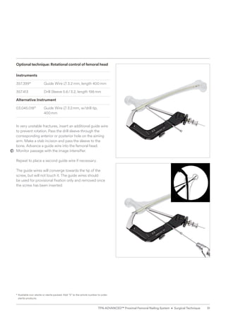 Optional technique: Rotational control of femoral head
Instruments
357.399* Guide Wire B 3.2mm, length 400mm
357.413 Drill Sleeve 5.6/3.2, length 198mm
Alternative Instrument
03.045.018* Guide Wire B 3.2mm, w/drill tip,
400mm
In very unstable fractures, insert an additional guide wire
to prevent rotation. Pass the drill sleeve through the
­
corresponding anterior or posterior hole on the aiming
arm. Make a stab incision and pass the sleeve to the
bone. Advance a guide wire into the femoral head. ­
Monitor passage with the image intensifier.
Repeat to place a second guide wire if necessary.
The guide wires will converge towards the tip of the
screw, but will not touch it. The guide wires should
be used for provisional fixation only and removed once
the screw has been inserted.
* 
Available non-sterile or sterile packed. Add “S” to the article number to order
sterile products.
31
TFN-ADVANCED™ Proximal Femoral Nailing System • Surgical Technique
 