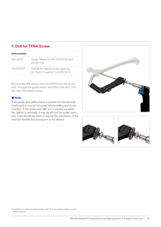 7. Drill for TFNA Screw
Instruments
03.037.117 Guide Sleeve for No. 03.037.115 and
03.037.215
03.037.021* Drill Bit for lateral cortex opening,
for Quick Coupling for DHS/DCS
Remove the drill sleeve. Pass the drill bit over the guide
wire, through the guide sleeve, and drill to the stop. This
will open the lateral cortex.
■ Note:
If the guide wire deflected as it passed into the femoral
head/neck, it may be removed before drilling and screw
insertion. If the guide wire falls out or comes out when
the drill bit is removed, it may be left out for screw inser-
tion. Care should be taken to ensure the orientation of the
insertion handle and aiming arm is not altered.
* 
Available non-sterile or sterile packed. Add “S” to the article number to order
sterile products.
33
TFN-ADVANCED™ Proximal Femoral Nailing System • Surgical Technique
 