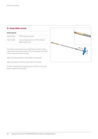 9. Assemble screw
Instruments
03.037.025 TFNA Screw Inserter
03.037.026 Connecting Screw for TFNA Helical
Blade and Screw
Insert the connecting screw and thread in until it is fully
captured in the screw inserter. The connecting screw will
remain attached to the inserter.
Select the appropriate screw length as measured.
Align the back end of the screw with the inserter.
Further, thread the connecting screw into the screw and
finger tighten the assembly.
Proximal Locking
36 Surgical Technique • TFN-ADVANCED™ Proximal Femoral Nailing System
 