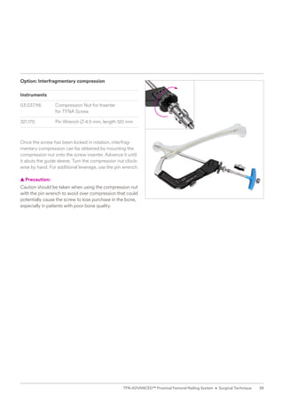 Option: Interfragmentary compression
Instruments
03.037.116 Compression Nut for Inserter
for TFNA Screw
321.170 Pin Wrench B 4.5 mm, length 120 mm
Once the screw has been locked in rotation, interfrag-
mentary compression can be obtained by mounting the
compression nut onto the screw inserter. Advance it until
it abuts the guide sleeve. Turn the compression nut clock-
wise by hand. For additional leverage, use the pin wrench.
  
▲ Precaution:
Caution should be taken when using the compression nut
with the pin wrench to avoid over compression that could
potentially cause the screw to lose purchase in the bone,
especially in patients with poor bone quality.
39
TFN-ADVANCED™ Proximal Femoral Nailing System • Surgical Technique
 