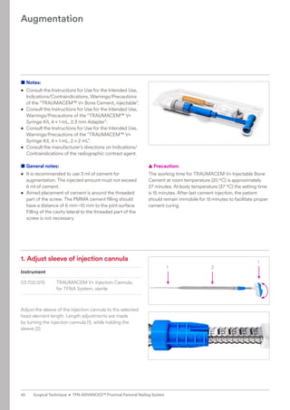 1 2
1
1. 
Adjust sleeve of injection cannula
Instrument
03.702.121S TRAUMACEM V+ Injection Cannula,
for TFNA System, sterile
Adjust the sleeve of the injection cannula to the selected
head element length. Length adjustments are made ­
by turning the injection cannula (1), while holding the
sleeve (2).
■ Notes:
• Consult the Instructions for Use for the Intended Use,
Indications/Contraindications, Warnings/Precautions
of the “TRAUMACEM™ V+ Bone Cement, injectable”.
• Consult the Instructions for Use for the Intended Use,
Warnings/Precautions of the “TRAUMACEM™ V+
Syringe Kit, 4 × 1 mL, 2.3 mm Adapter”.
• Consult the Instructions for Use for the Intended Use,
Warnings/Precautions of the “TRAUMACEM™ V+
Syringe Kit, 4 × 1 mL, 2 × 2 mL”.
• Consult the manufacturer’s directions on Indications/
Contraindications of the radiographic contrast agent.
■ General notes:
• 
It is recommended to use 3 ml of cement for
augmentation. The injected amount must not exceed
6 ml of cement.
• 
Aimed placement of cement is around the threaded
part of the screw. The PMMA cement filling should
have a distance of 6 mm–10 mm to the joint surface.
Filling of the cavity lateral to the threaded part of the
screw is not necessary.
Augmentation
  
▲ Precaution:
The working time for TRAUMACEM V+ Injectable Bone
Cement at room temperature (20 °C) is approximately
27 minutes. At body temperature (37 °C) the setting time
is 15 minutes. After last cement injection, the patient
should remain immobile for 15minutes to facilitate proper
cement curing.
42 Surgical Technique • TFN-ADVANCED™ Proximal Femoral Nailing System
 
