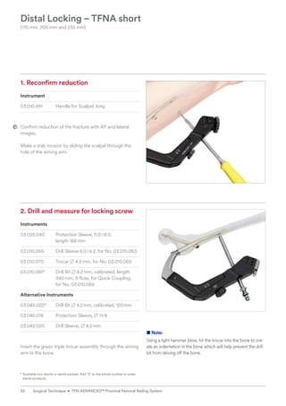 1. Reconfirm reduction
Instrument
03.010.491 Handle for Scalpel, long
Confirm reduction of the fracture with AP and lateral
images.
Make a stab incision by sliding the scalpel through the
hole of the aiming arm.
Distal Locking ­
– TFNA short
(170 mm, 200 mm and 235 mm)
2. 
Drill and measure for locking screw
Instruments
03.025.040 Protection Sleeve,11.0/8.0,
length 188mm
03.010.065 Drill Sleeve 8.0/4.2, for No. 03.010.063
03.010.070 Trocar B 4.2mm, for No. 03.010.065
03.010.061* Drill Bit B 4.2mm, calibrated, length
340mm, 3-flute, for Quick Coupling,
for No. 03.010.065
Alternative Instruments
03.045.022* Drill Bit B 4.2mm, calibrated, 120mm
03.045.019 Protection Sleeve, B 11/8
03.045.020 Drill Sleeve, B 4.2mm
Insert the green triple trocar assembly through the ­
aiming
arm to the bone.
* 
Available non-sterile or sterile packed. Add “S” to the article number to order
sterile products.
■ Note:
Using a light hammer blow, hit the trocar into the bone to cre-
ate an indentation in the bone which will help prevent the drill
bit from skiving off the bone.
52 Surgical Technique • TFN-ADVANCED™ Proximal Femoral Nailing System
 