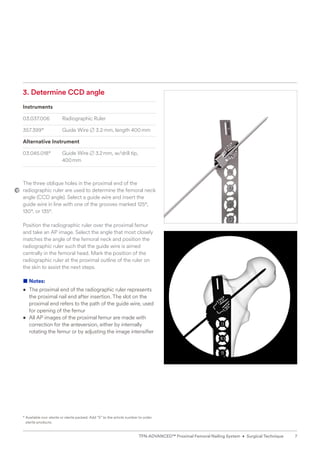 3. Determine CCD angle
Instruments
03.037.006 Radiographic Ruler
357.399* Guide Wire B 3.2mm, length 400mm
Alternative Instrument
03.045.018* Guide Wire B 3.2mm, w/drill tip,
400mm
The three oblique holes in the proximal end of the
radiographic ruler are used to determine the femoral neck
angle (CCD angle). Select a guide wire and insert the
guide wire in line with one of the grooves marked 125°,
130°, or 135°.
Position the radiographic ruler over the proximal femur
and take an AP image. Select the angle that most closely
matches the angle of the femoral neck and position the
radiographic ruler such that the guide wire is aimed
centrally in the femoral head. Mark the position of the
radiographic ruler at the proximal outline of the ruler on
the skin to assist the next steps.
■ Notes:
• The proximal end of the radiographic ruler represents
the proximal nail end after insertion. The slot on the
proximal end refers to the path of the guide wire, used
for opening of the femur
• All AP images of the proximal femur are made with
correction for the anteversion, either by internally
rotating the femur or by adjusting the image intensifier
* 
Available non-sterile or sterile packed. Add “S” to the article number to order
sterile products.
7
TFN-ADVANCED™ Proximal Femoral Nailing System • Surgical Technique
 