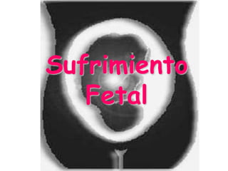 Sufrimiento
Fetal
 