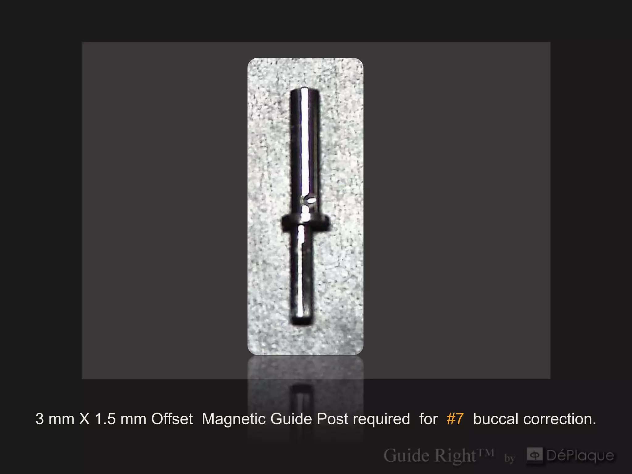 `




3 mm X 1.5 mm Offset Magnetic Guide Post required for #7 buccal correction.
 