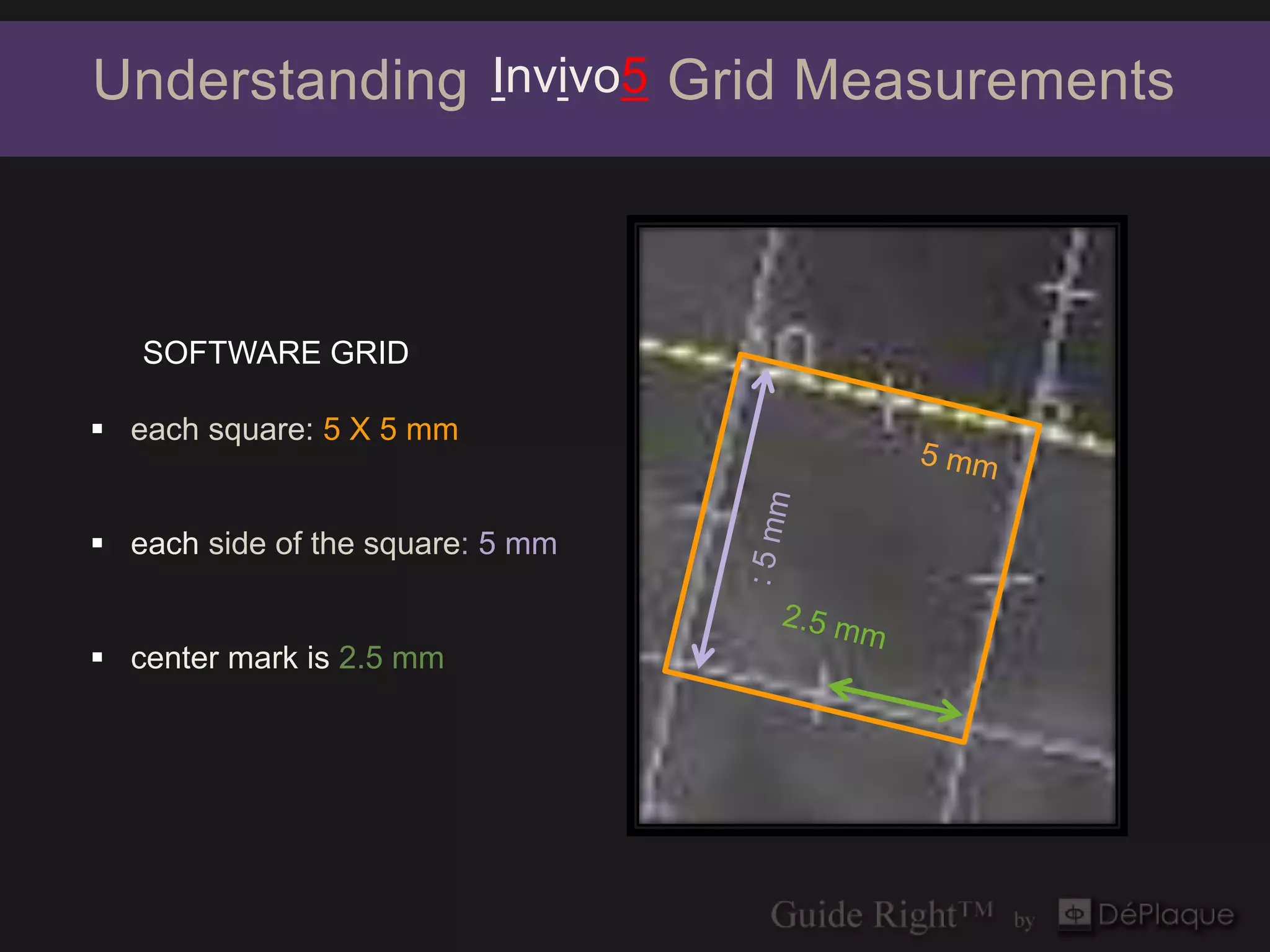 Understanding Invivo5 Grid Measurements



   SOFTWARE GRID

 each square: 5 X 5 mm


 each side of the square: 5 mm


 center mark is 2.5 mm


                                  tangential
 
